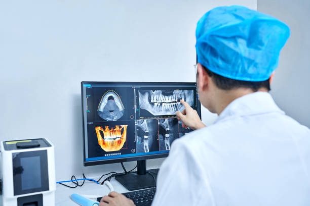 Best Chipped Tooth Repair Near Me  in Selma, CA